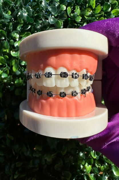 Clip-on Braces