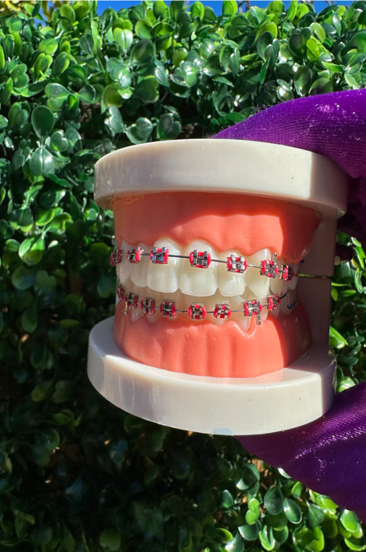 Clip-on Braces